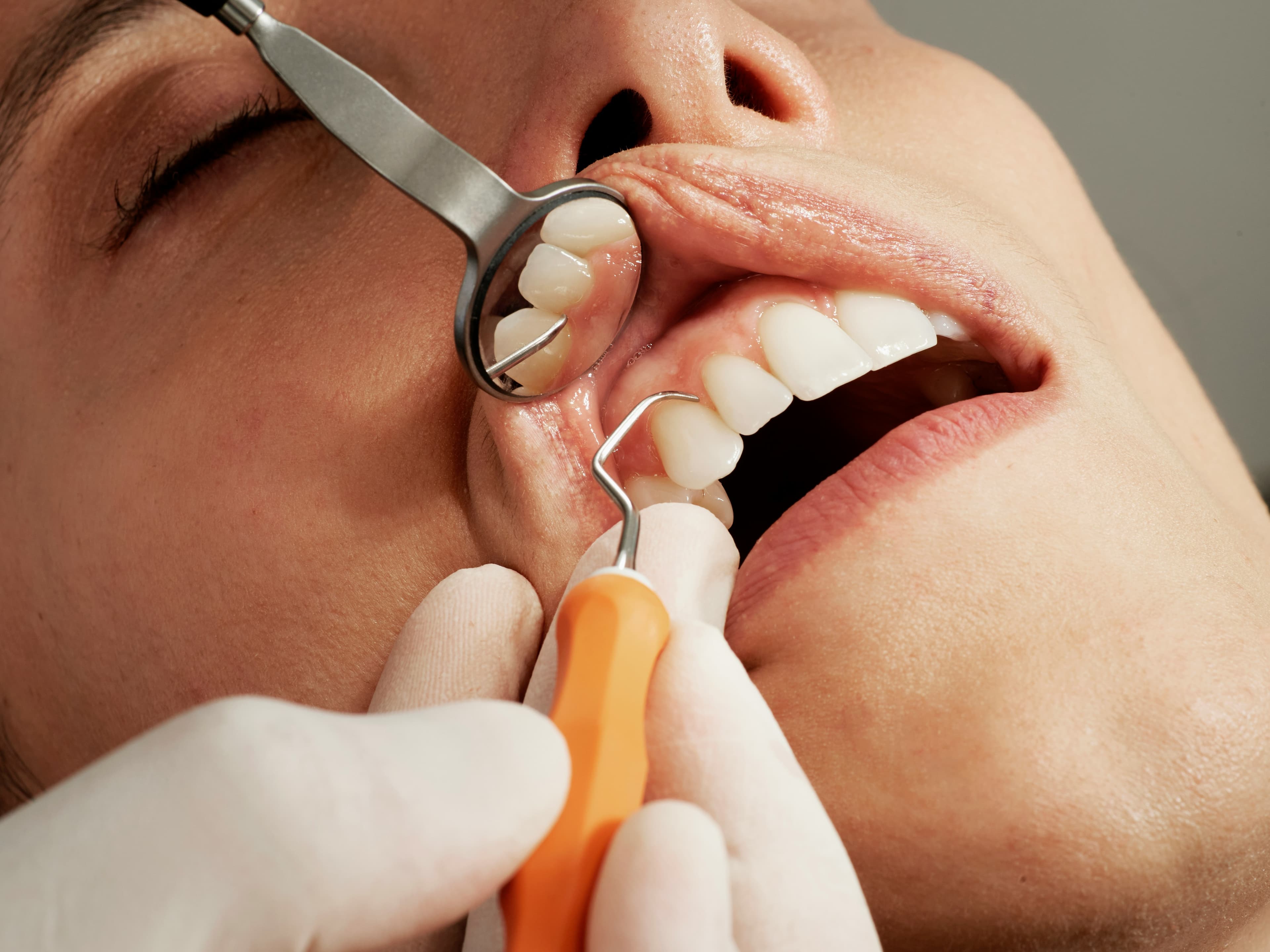 Gum Disease Treatments